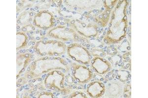 Immunohistochemistry of paraffin-embedded Rat kidney using MT-ND5 Polyclonal Antibody at dilution of 1:100 (40x lens). (MT-ND5 antibody)
