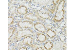 Immunohistochemistry of paraffin-embedded Rat kidney using MT-ND5 Polyclonal Antibody at dilution of 1:100 (40x lens).