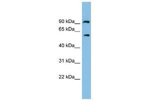 ALDH7A1 antibody used at 1 ug/ml to detect target protein. (ALDH7A1 antibody  (N-Term))