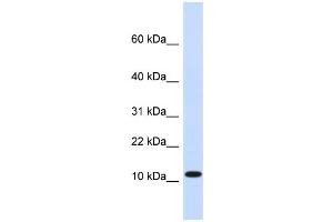 WB Suggested Anti-HMGN1 Antibody Titration:  0. (HMGN1 antibody  (Middle Region))