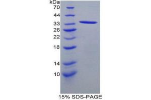 SDS-PAGE (SDS) image for Angiopoietin 4 (ANGPT4) (AA 36-297) protein (His tag) (ABIN2124005) (Angiopoietin 4 Protein (ANGPT4) (AA 36-297) (His tag))