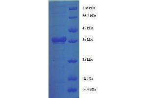 Ribosomal Protein, Large, p1 (RPLP1) (AA 2-114), (full length) protein (GST tag)
