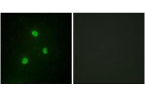Immunofluorescence analysis of A549 cells, using TBX1 Antibody. (T-Box 1 antibody  (AA 311-360))