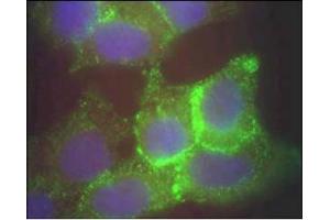 Image no. 1 for anti-Jagged 1 (JAG1) (AA 110-125) antibody (ABIN401024) (JAG1 antibody  (AA 110-125))