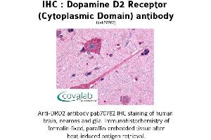 Image no. 1 for anti-Dopamine Receptor D2 (DRD2) (3rd Cytoplasmic Domain) antibody (ABIN1733734)