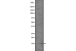 Western blot analysis of Histone H3 (mono+di+tri methyl K14) using HUVEC whole cell lysates (Histone 3 antibody  (H3K14me, H3K14me2, H3K14me3))