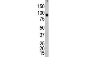 Western blot analysis of ERK4 antibody and mouse brain tissue lysate. (MAPK7 antibody  (AA 527-557))