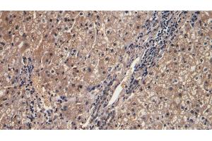Detection of IFNg in Human Liver Tissue using Monoclonal Antibody to Interferon Gamma (IFNg) (Interferon gamma antibody  (AA 24-166))