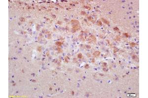Formalin-fixed and paraffin embedded rat brain labeled with Rabbit Anti pro-caspase-3 Polyclonal Antibody, Unconjugated (ABIN747728) at 1:200 followed by conjugation to the secondary antibody and DAB staining (Caspase 3 antibody  (AA 11-120))