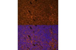 Immunofluorescence analysis of mouse embryos cells using PTCH1 antibody (ABIN1682368, ABIN1682367, ABIN3015342, ABIN3015343 and ABIN6213997) at dilution of 1:100. (Patched 1 antibody  (AA 1214-1312))