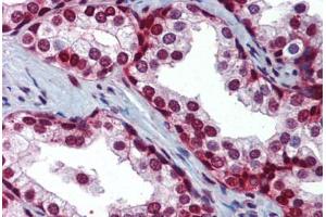 Human Prostate (formalin-fixed, paraffin-embedded) stained with SLC35A5 antibody ABIN462241 followed by biotinylated goat anti-rabbit IgG secondary antibody ABIN481713, alkaline phosphatase-streptavidin and chromogen. (SLC35A5 antibody  (AA 36-85))