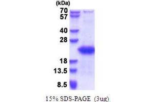 SDS-PAGE (SDS) image for Gametocyte Specific Factor 1 (GTSF1) (AA 1-167) protein (His tag) (ABIN5853638)
