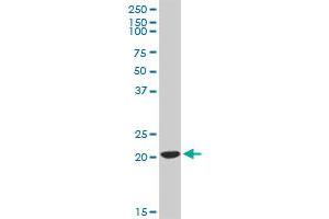 BID MaxPab rabbit polyclonal antibody. (BID antibody  (AA 1-195))