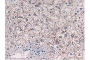 IHC-P analysis of Human Liver Tissue, with DAB staining. (CCL2 antibody  (AA 24-99))