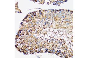 Immunohistochemistry of paraffin-embedded rat testis using IRAK4 antibody. (IRAK4 antibody)