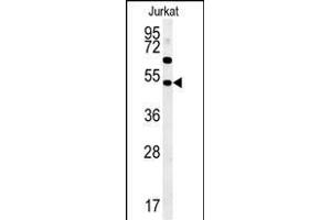 SSN1 Antibody (Center) (ABIN652058 and ABIN2840526) western blot analysis in Jurkat cell line lysates (35 μg/lane). (SAMSN1 antibody  (AA 255-283))