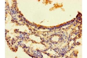 Immunohistochemistry of paraffin-embedded human lung tissue using ABIN7166376 at dilution of 1:100 (ZNF738 antibody  (AA 1-137))