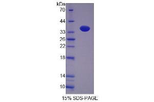 SDS-PAGE (SDS) image for Nucleoside Phosphorylase (NP) (AA 1-289) protein (His tag) (ABIN4989457)