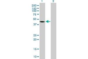 Western Blot analysis of KCTD18 expression in transfected 293T cell line by KCTD18 MaxPab polyclonal antibody. (KCTD18 antibody  (AA 1-426))