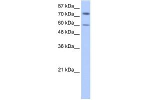 WB Suggested Anti-IGF2BP1 Antibody Titration:  0.