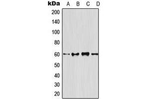 Western blot analysis of Osteoprotegerin expression in HeLa (A), mouse brain (B), rat brain (C), PC12 (D) whole cell lysates. (Osteoprotegerin antibody  (N-Term))