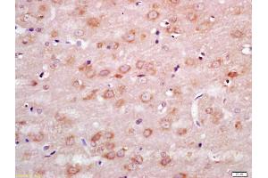 Immunohistochemistry (IHC) image for anti-Wingless-Type MMTV Integration Site Family, Member 7B (WNT7B) (N-Term) antibody (ABIN716291)
