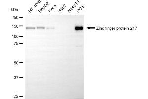 Western blotting analysis using zinc finger protein 217 antibody (ABIN7800894). (Recombinant ZNF217 antibody)