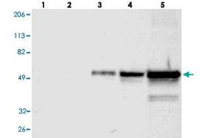 Western blot analysis of Lane 1: RT-4, Lane 2: U-251 MG, Lane 3: A-431, Lane 4: Liver, Lane 5: Tonsil with FGB polyclonal antibody .