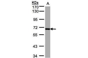 WB Image Sample(30 ug whole cell lysate) A:Raji , 7. (PLK1 antibody)
