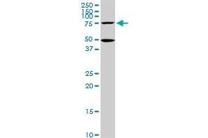 HSGT1 monoclonal antibody (M02), clone 1E5. (ECD/SGT1 antibody  (AA 1-644))