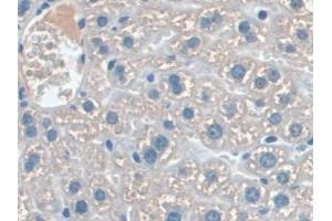Immunohistochemistry (IHC) image for anti-Interleukin 22 Receptor, alpha 2 (IL22RA2) (AA 31-223) antibody (ABIN7435862)