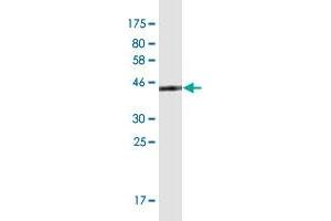 Western Blot detection against Immunogen (42. (BLOC1S2 antibody  (AA 1-142))