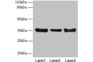 Western blot All lanes: ZNF625 antibody at 4 μg/mL Lane 1: Mouse brain tissue Lane 2: Mouse lung tissue Lane 3: Mouse ovarian tissue Secondary Goat polyclonal to rabbit IgG at 1/10000 dilution Predicted band size: 35, 43 kDa Observed band size: 35 kDa (ZNF625 antibody  (AA 1-306))