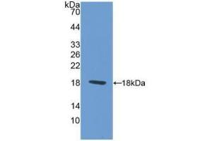 Detection of Recombinant PAX6, Rat using Polyclonal Antibody to Paired Box Gene 6 (PAX6) (PAX6 antibody  (AA 1-130))