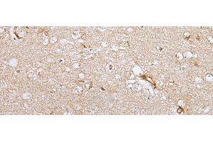 Immunohistochemistry of paraffin-embedded Human brain tissue using HOXC9 Polyclonal Antibody at dilution of 1:35(x200) (HOXC9 antibody)