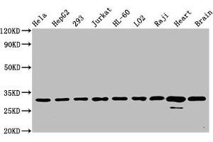 Western Blot Positive WB detected in: Hela whole cell lysate, HepG2 whole cell lysate, 293 whole cell lysate, Jurkat whole cell lysate, HL-60 whole cell lysate, LO2 whole cell lysate, Raji whole cell lysate, Rat heart tissue, Mouse brain tissue All lanes: VDAC1 antibody at 0. (Recombinant VDAC1 antibody)