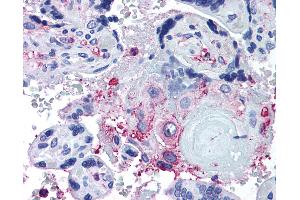 Anti-ADAMTS5 antibody IHC of human placenta. (ADAMTS5 antibody  (Internal Region))