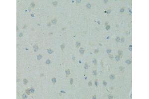 Immunohistochemistry of paraffin-embedded Rat brain using SMAD6 Polyclonal Antibody at dilution of 1:100 (40x lens). (SMAD6 antibody)