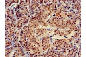 Immunohistochemistry of paraffin-embedded human pancreatic tissue using ABIN7173455 at dilution of 1:100 (TRIM5 antibody  (AA 1-493))