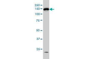 HDAC6 monoclonal antibody (M01), clone 1E2 Western Blot analysis of HDAC6 expression in Hela S3 NE . (HDAC6 antibody  (AA 1128-1215))