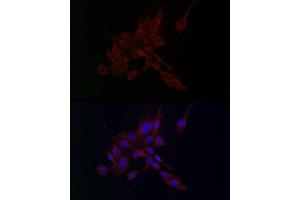 Immunofluorescence analysis of PC-12 cells using MMP2 antibody (ABIN6129301, ABIN6143911, ABIN6143913 and ABIN6221846) at dilution of 1:100. (MMP2 antibody  (AA 40-280))
