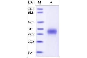 Human PLGF, His Tag on SDS-PAGE under reducing (R) condition. (PLGF Protein (AA 19-170) (His tag))