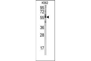 Image no. 1 for anti-Cytochrome P450, Family 4, Subfamily F, Polypeptide 8 (CYP4F8) (C-Term) antibody (ABIN360258)