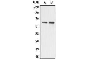 Western blot analysis of AATF expression in HUVEC (A), HeLa (B) whole cell lysates. (AATF antibody  (N-Term))