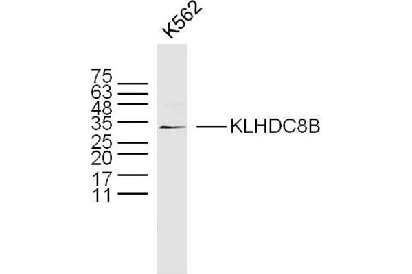 KLHDC8B 抗体  (AA 201-300)