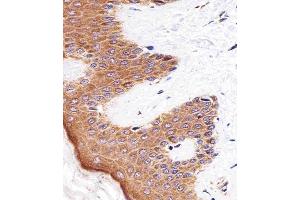 Immunohistochemical analysis of paraffin-embedded H. (BLMH antibody  (AA 212-242))