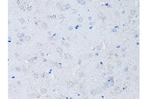 Immunohistochemistry of paraffin-embedded mouse brain using RYR2 Antibody (ABIN5970123) at dilution of 1/100 (40x lens). (RYR2 antibody)