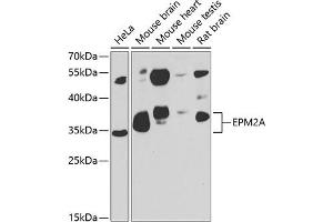 Western blot analysis of extracts of various cell lines, using EPM2A antibody (ABIN6131609, ABIN6140229, ABIN6140230 and ABIN6222778) at 1:1000 dilution. (EPM2A antibody  (AA 244-331))