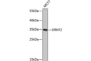 Western blot analysis of extracts of MCF-7 cells using SPINT2 Polyclonal Antibody at dilution of 1:1000. (SPINT2 antibody)