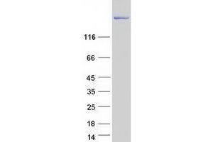 Western Blotting (WB) image for Tight Junction Protein 1 (TJP1) (Transcript Variant 1) protein (Myc-DYKDDDDK Tag) (ABIN2736150)